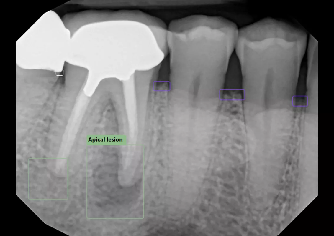 DEXIS Imaging Suite DEXassist Early Access DEXIS